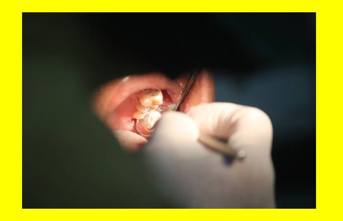 Best Treatment Tooth Decay