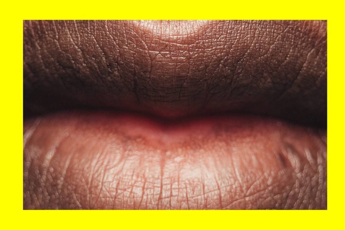 ulcer
