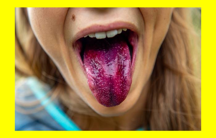 ulcer treatment