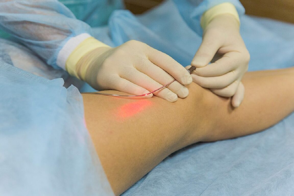 Modern Vein Treatments_ What Patients Need to Know Before Choosing Care