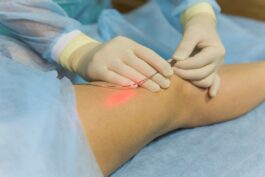 Modern Vein Treatments_ What Patients Need to Know Before Choosing Care