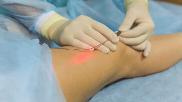 Modern Vein Treatments_ What Patients Need to Know Before Choosing Care