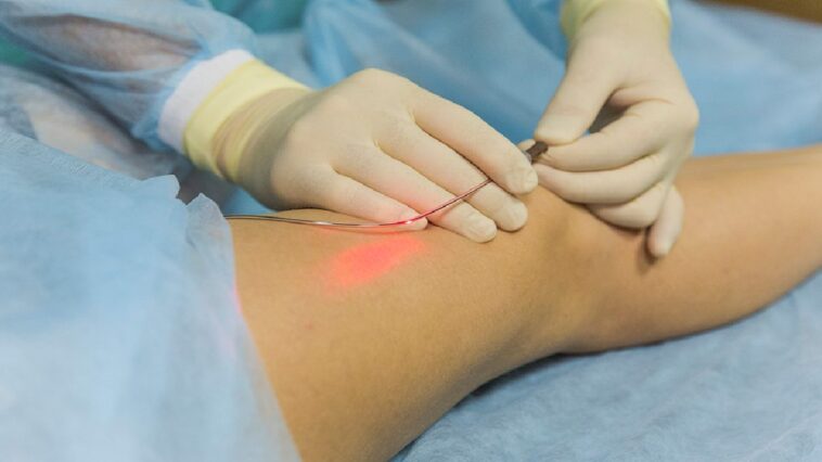 Modern Vein Treatments_ What Patients Need to Know Before Choosing Care
