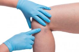 How to Choose a Vein Specialist in a Major City: What Patients Should Look For