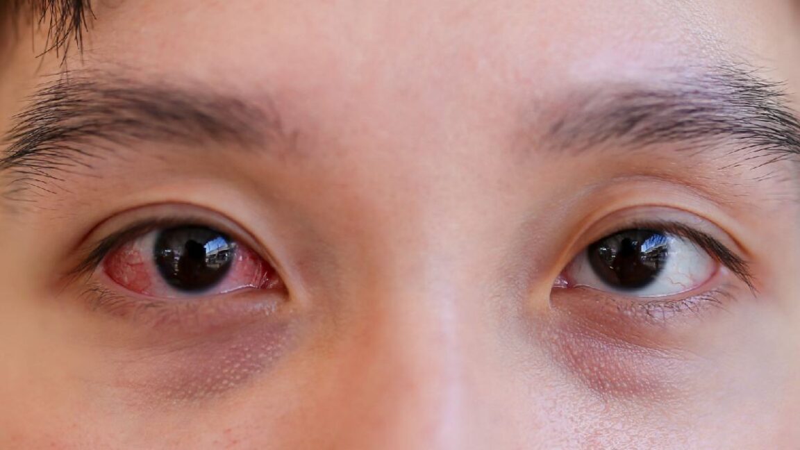 Why Early Detection Matters: Catching Eye Conditions Before They Worsen 