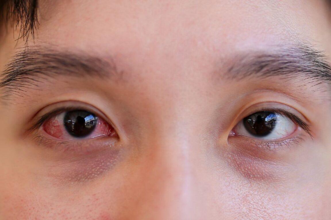 Why Early Detection Matters: Catching Eye Conditions Before They Worsen 