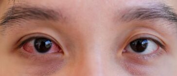 Why Early Detection Matters: Catching Eye Conditions Before They Worsen 