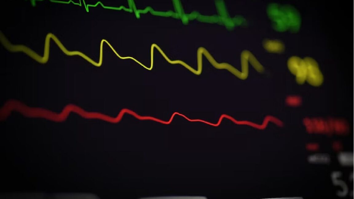 Dr. Nishi Patel: Stopping Cardiac Arrest Before It Starts