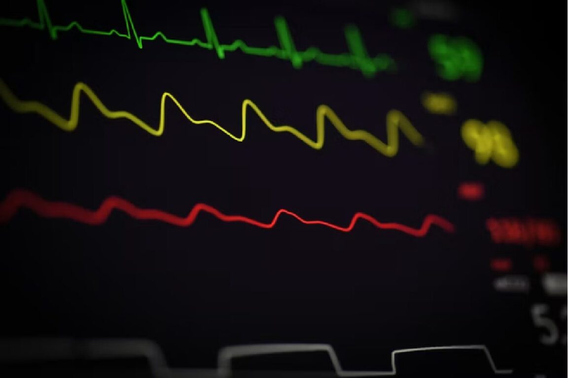Dr. Nishi Patel: Stopping Cardiac Arrest Before It Starts